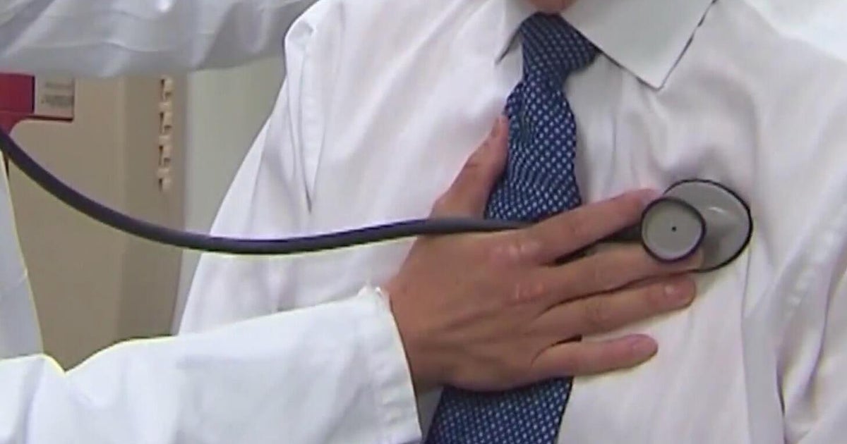 Northern California doctor shares ways to prevent strokes