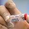 Why the FDA is limiting access to COVID-19 vaccines
