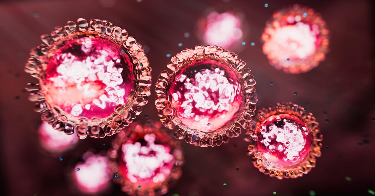 California has more than a dozen confirmed cases of measles so far in 2025 