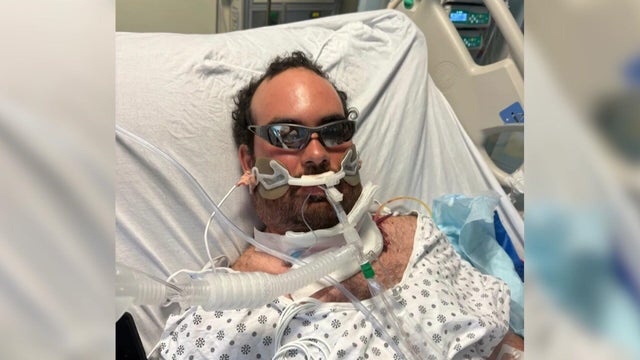 A man lays in a hospital bed with equipment attached to his neck and mouth. 