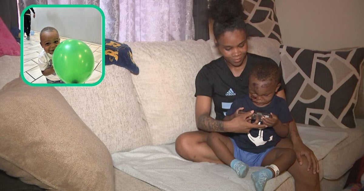 Toddler injured in Strawberry Mansion hit-and-run released from hospital 