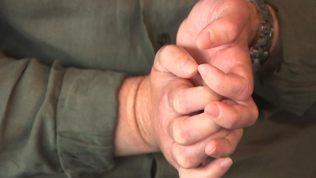 penn-medicine-hand-transplant.jpg