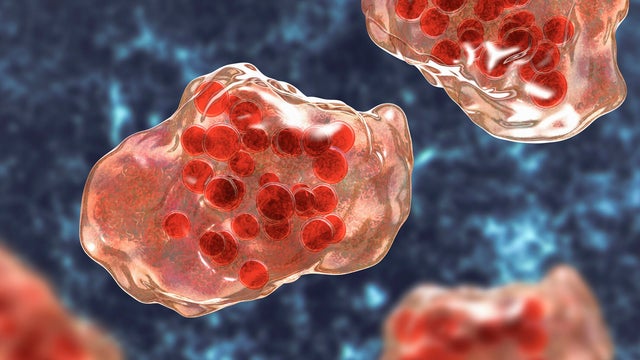 Measles virus infection, illustration 