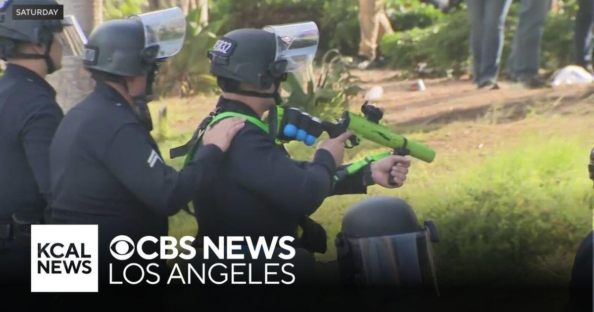 Los Angeles Protester Hospitalized After Rubber Bullet Eye Injury During No Kings Rally