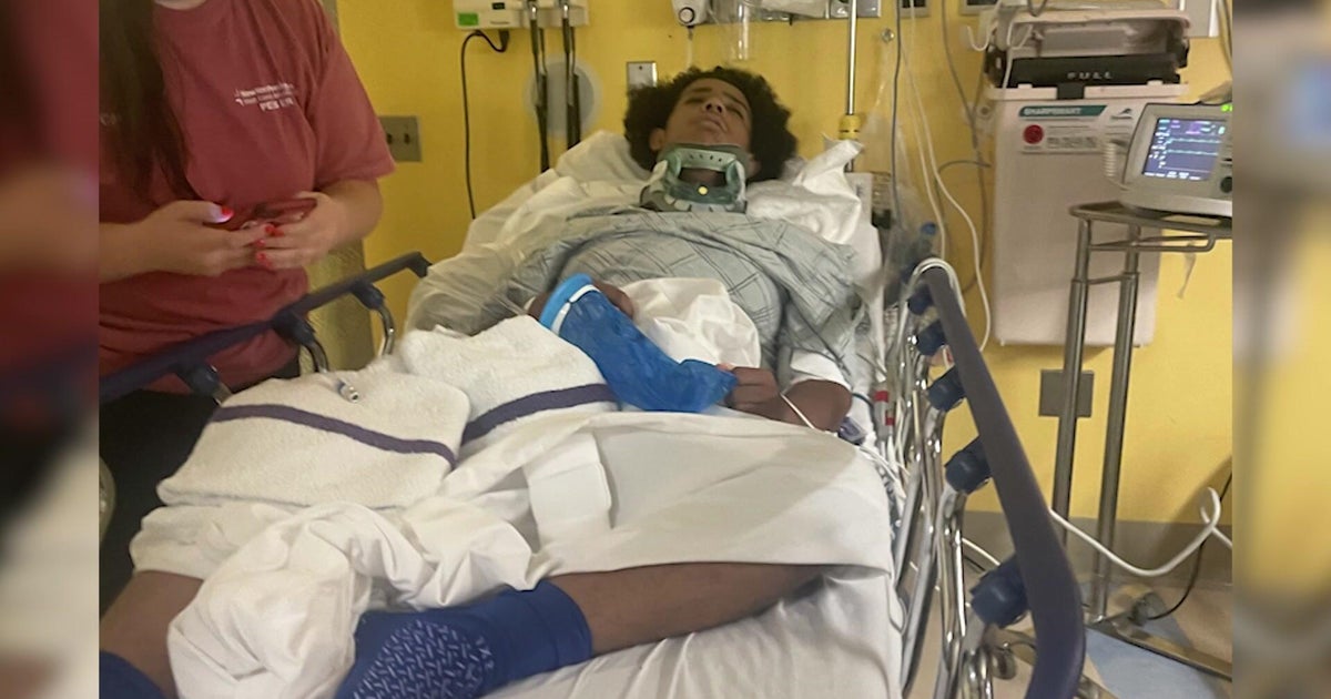 NYC teen says he couldn't talk, move after being struck by lightning 