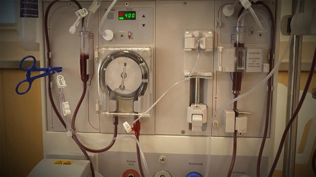 0622-sunmo-kidney.jpg 