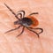 Tick bites are causing a spike in ER visits this year. An expert explains why.