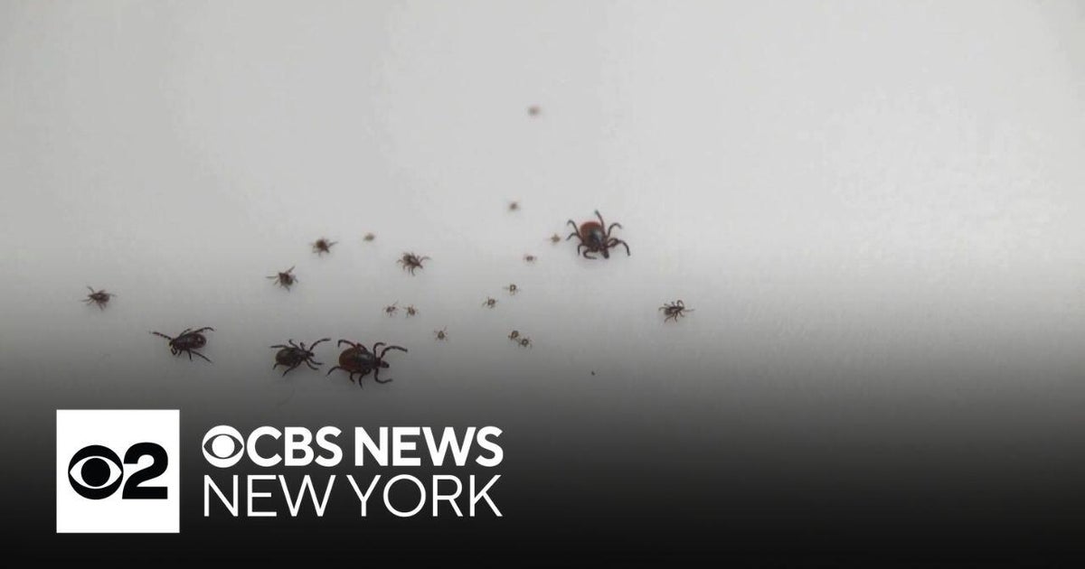 Northeast at high risk for tick bites as ER visits spike - CBS New York
