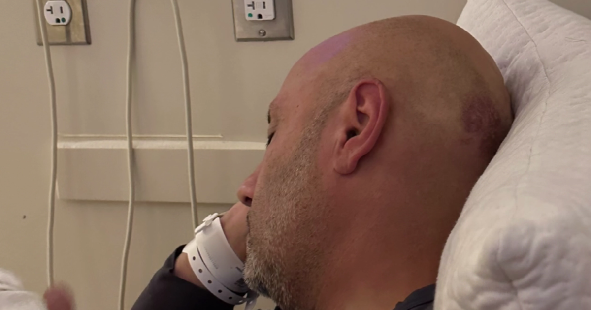 Man says he was robbed, brutally attacked while leaving bar in River North 