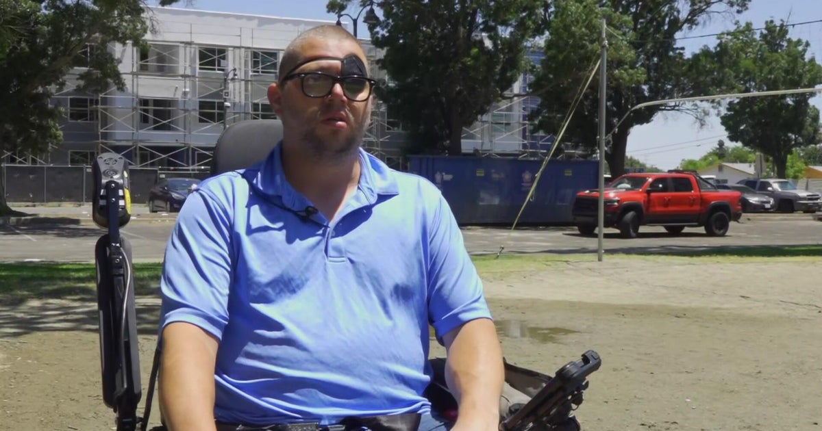 Disabled Fairfield resident hauls trash 2 miles away on wheelchair as sanitation strike continues 