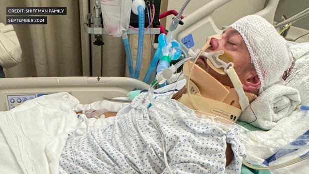 Peter Shiffman lying in a hospital bed in a medically induced coma 