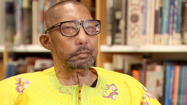 18pkg-ss-first-black-male-face-transplant-frame-944-1.jpg 