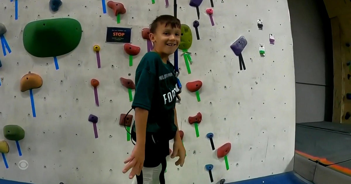 Children with hand and arm differences learning to rock climb at special camp