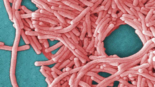 Legionnaires Disease 