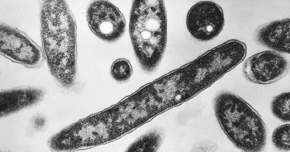 Doctor explains science behind the Legionnaires' outbreak in NYC 