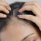 40% of women affected by female pattern hair loss by age 50, study finds