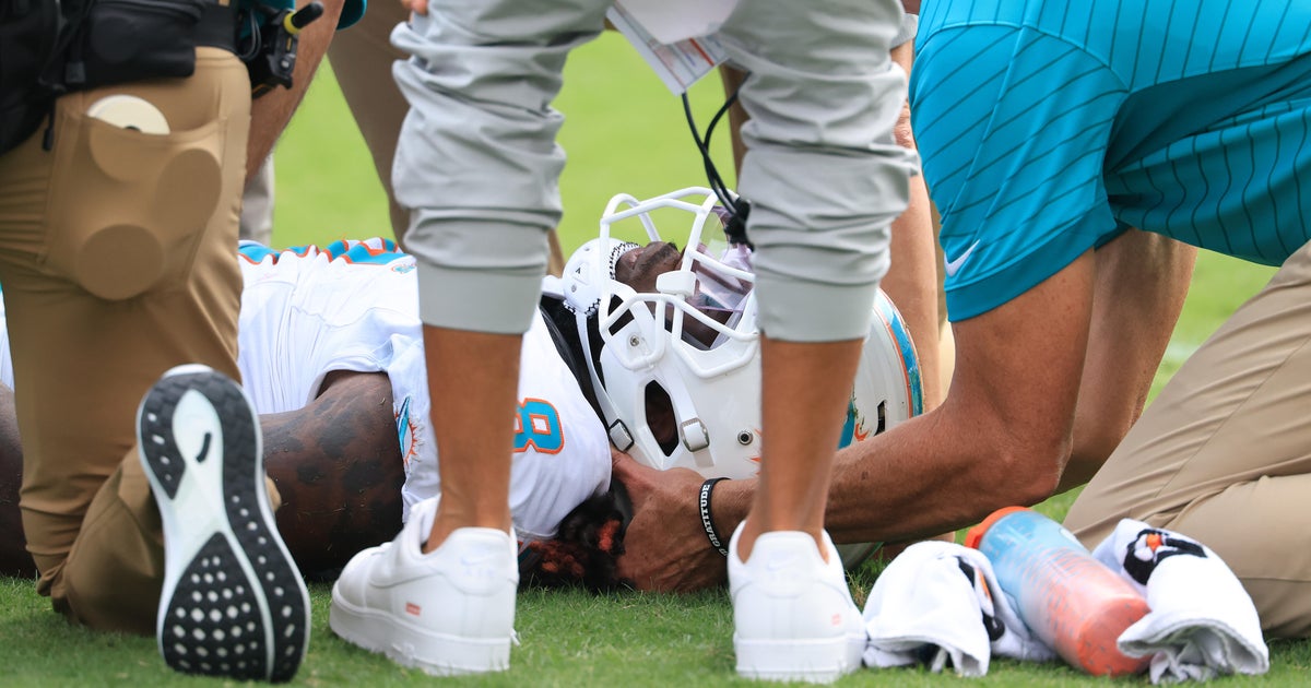 Miami Dolphins RB Alexander Mattison out after season-ending surgery