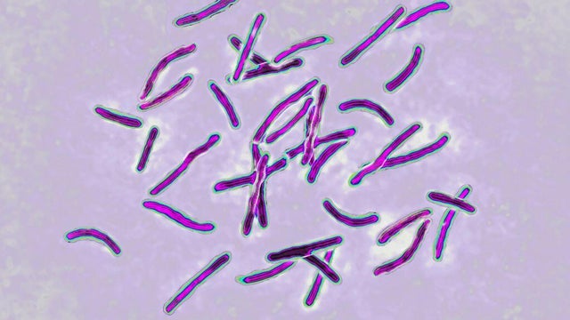 Koch's bacillus 