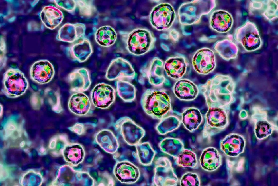 Coroner releases details on 2 infant deaths in Pennsylvania measles outbreak