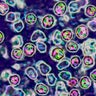 Measles case reported in Minneapolis school; 9 other cases reported this week 