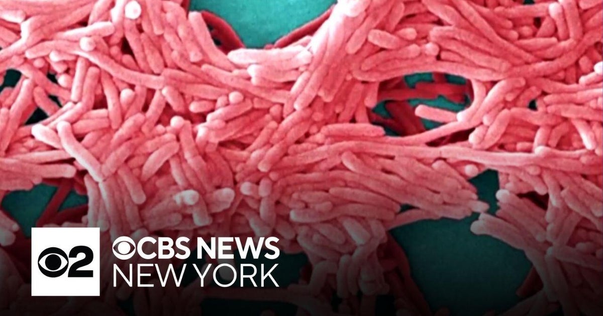 5th Legionnaires' disease death in New York City - CBS New York