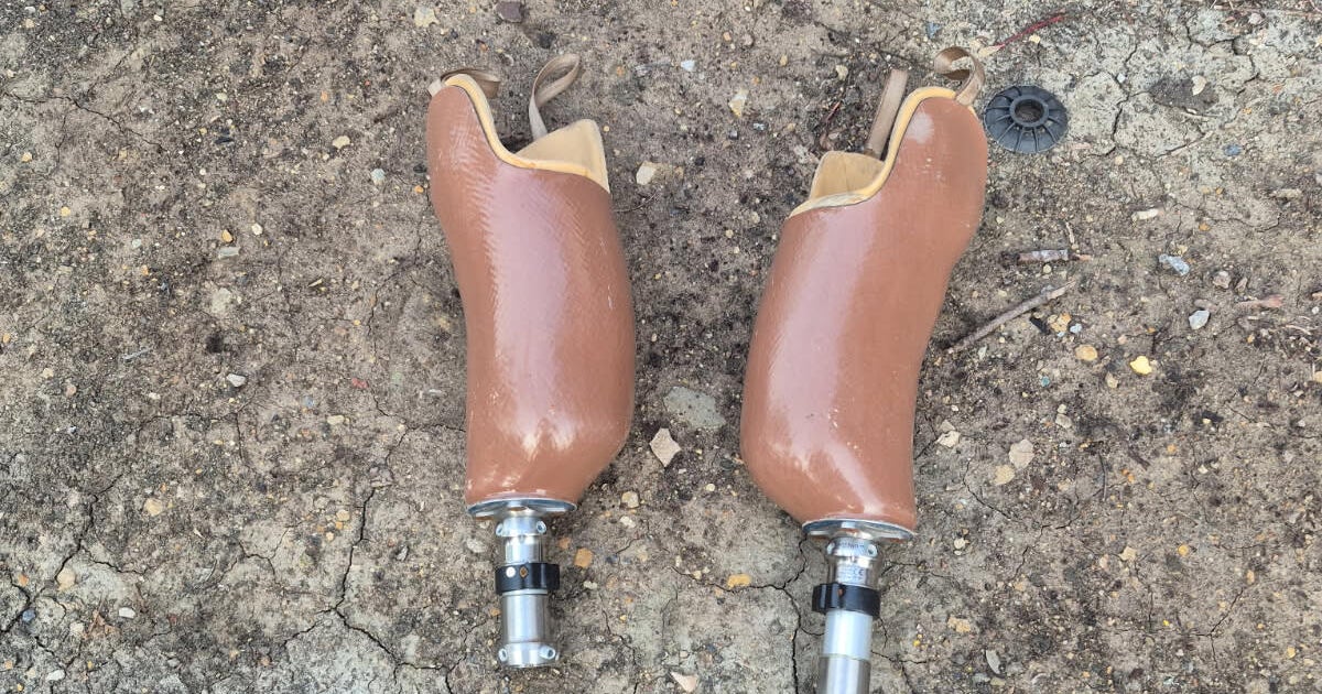 Chicago man trying to reunite found prosthetics with rightful owner 