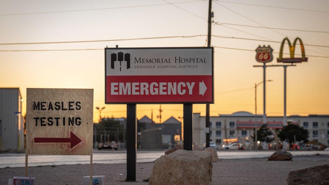 One Death Reported As Texas Measles Outbreak Spreads 