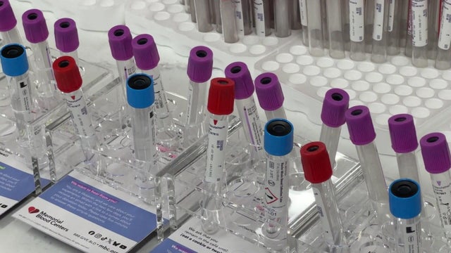 5p-pkg-blood-shortage-wcco8k91.jpg 