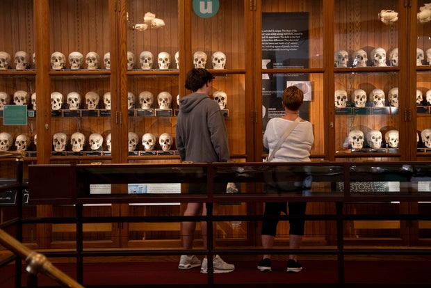 Milo Tivy, 16, and Shari Tivy, 75, look at a display of human skulls at the Mütter Museum on Thursday, Aug. 21, 2025, in Philadelphia. 