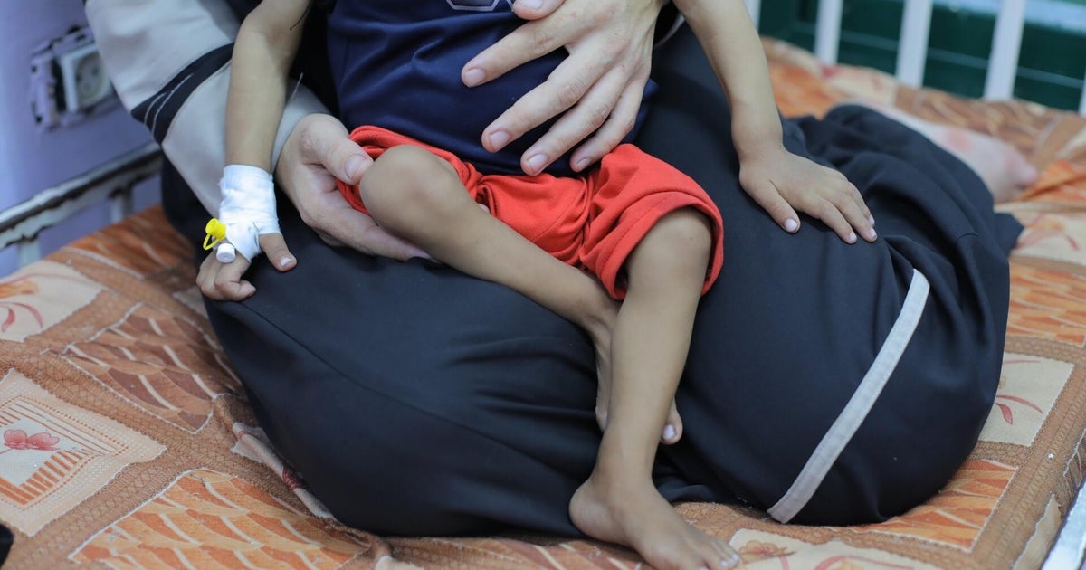 Israel denies U.N.'s declaration of famine in Gaza