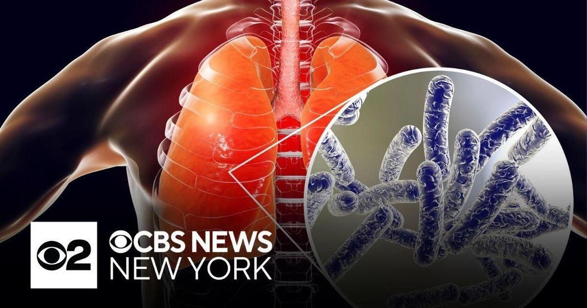 Legionnaires' reported at Bronx apartment building, NYC health officials say