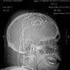 Dr. Sanjay Gupta on the mysteries of chronic pain 