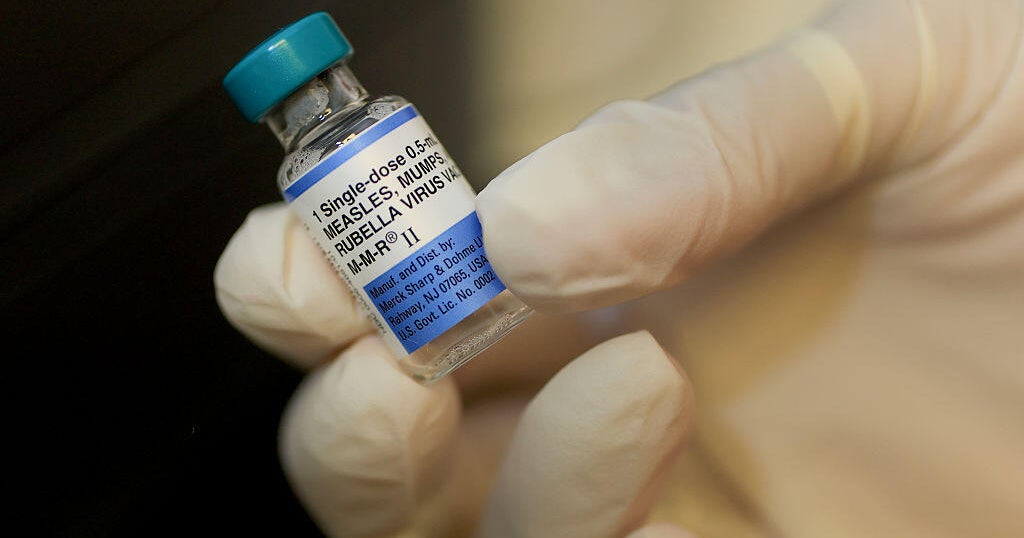 Trump's call to split up the MMR childhood vaccine revives long-settled debate