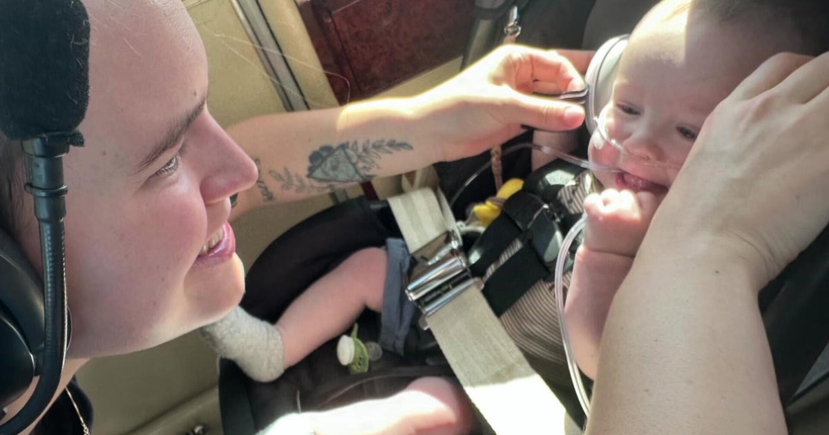 Lakeville baby with heart condition able to get surgery in Boston thanks to volunteer pilots Lakeville baby with heart condition able to get surgery in Boston thanks to volunteer pilots