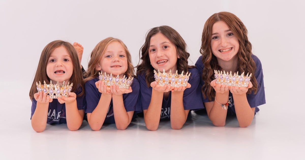 Four sisters diagnosed with rare brain condition: "Got to be kidding"