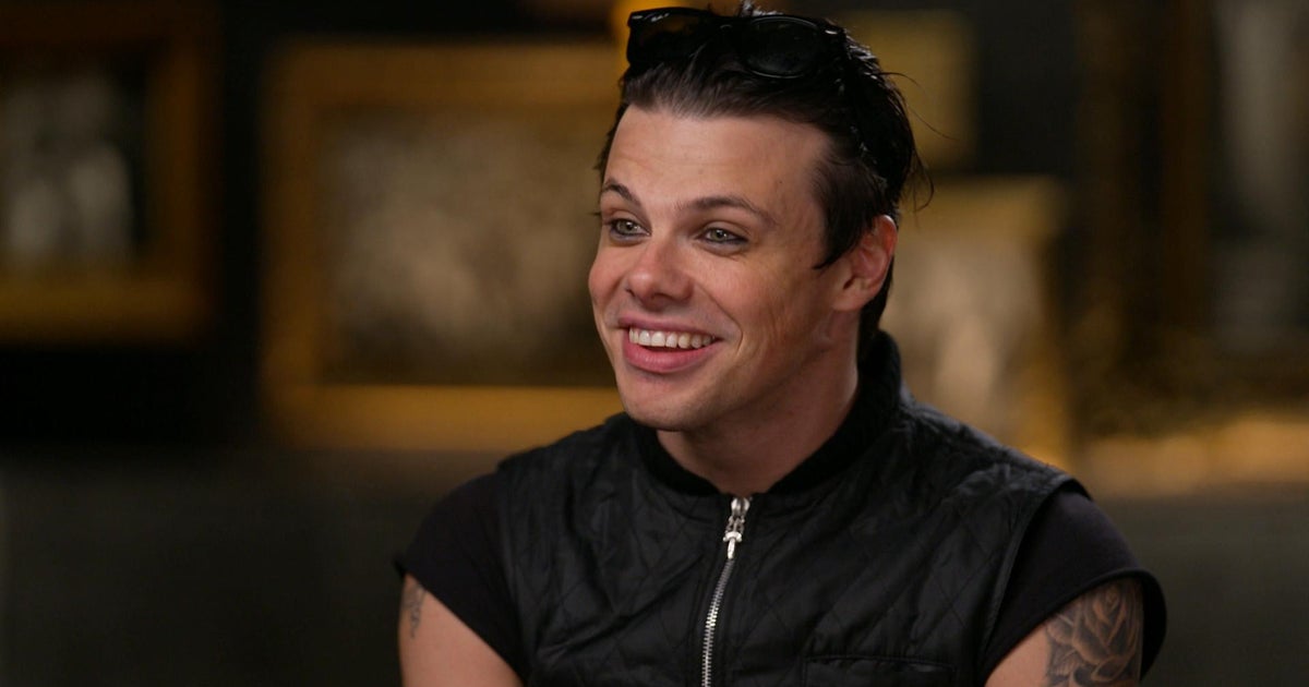 Yungblud: From Struggles to Stardom with Rock Legends