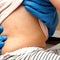 Growing concern over measles outbreak in South Carolina