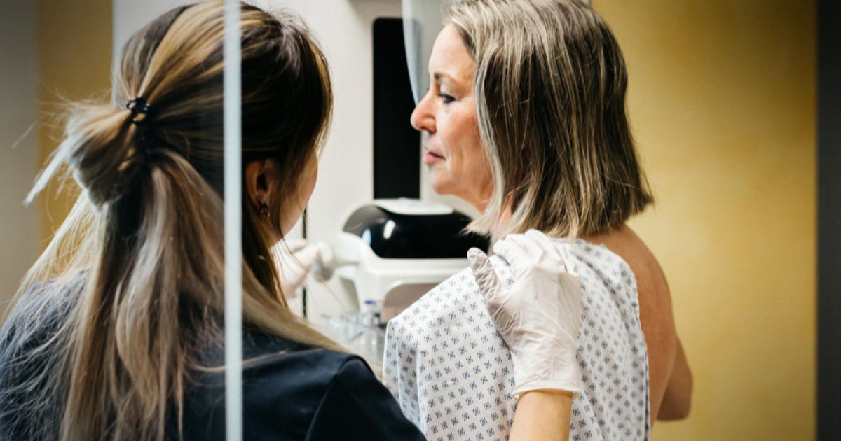 What women need to know about perimenopause and the end of fertility