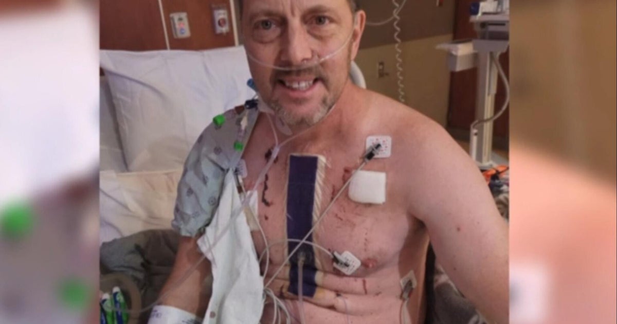 82-Year-Old Dave Obelkevich Prepares 50th New York City Marathon Completion