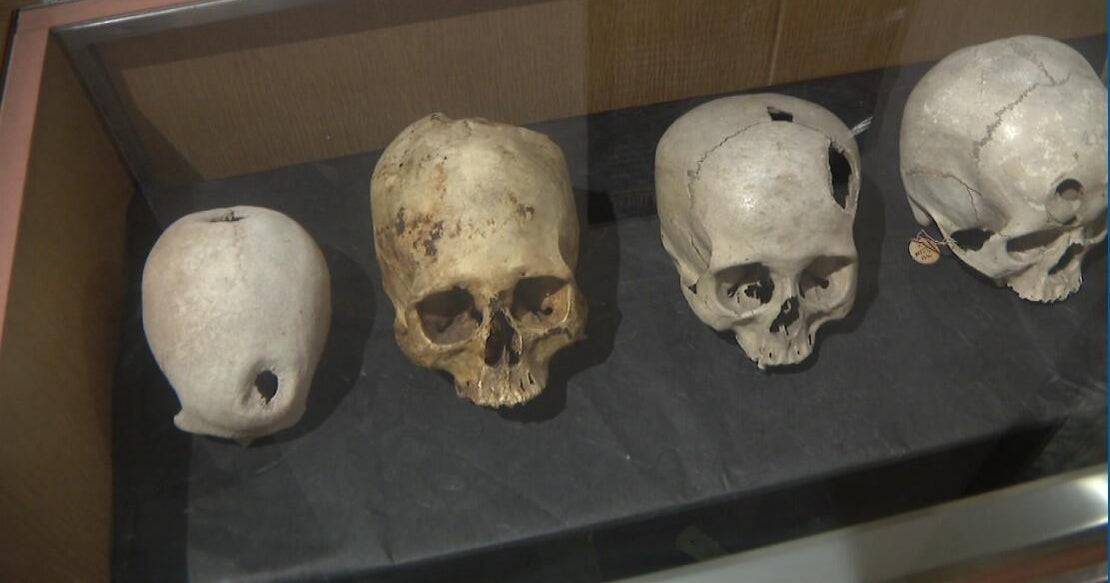 Chicago’s Hidden Gems: International Museum of Surgical Science showcases history of medicine