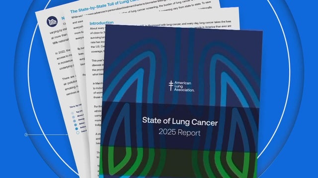 16pkg-ss-lung-cancer-report-transfer-frame-616.jpg 