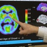 alzheimers-research-1920.jpg 
