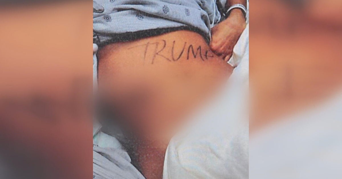 Ex-staffer for New Jersey Rep. Jeff Van Drew charged with staging faked political attack on herself