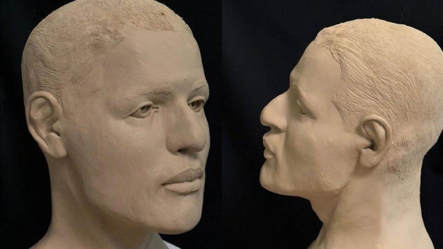 facial-reconstruction.jpg 
