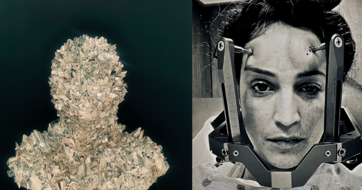 Nobody knew what was fallacious together with her — till an MRI discovered incurable illness. She turned her harrowing journey into distinctive artwork.