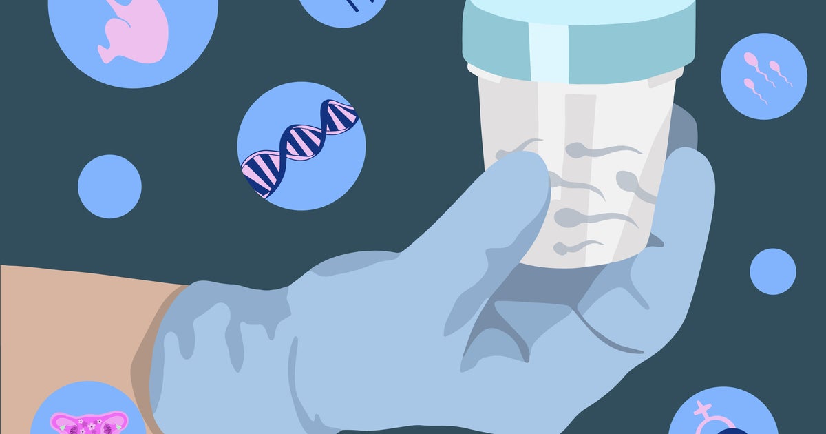 Лондон — Сперма от донор който несъзнателно носи ген причиняващ рак