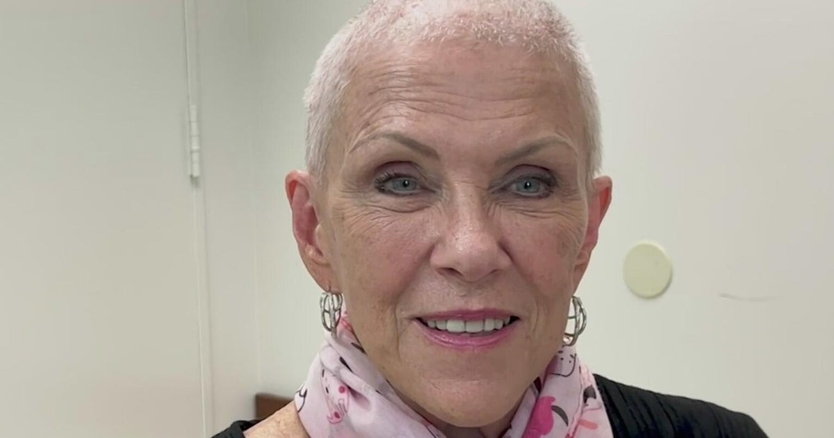 Deep brain stimulation helping woman with Parkinson’s disease improve quality of life