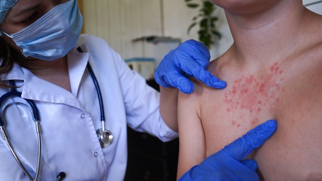 The physician is inspecting the boy's skin for health issues. 