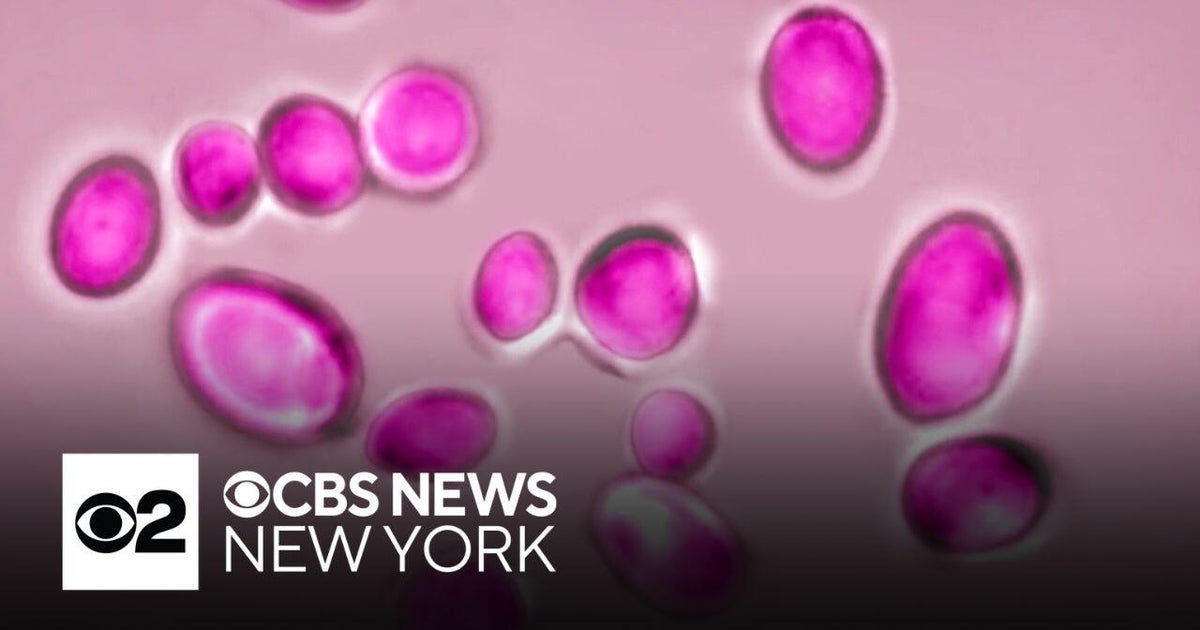 Dangerous, drug-resistant fungus is spreading across hospitals, nursing ...