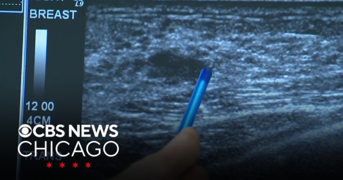 Cancer survival rates climbing | Health Watch